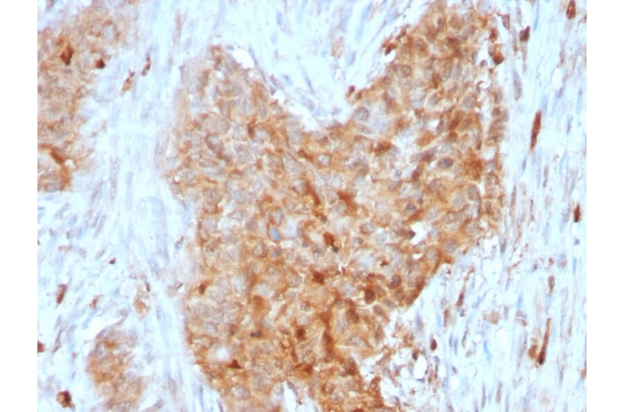 Immunohistochemistry - Anti-Glucose 6 Phosphate Isomerase Antibody [CPTC-GPI-1] (A248753) - Antibodies.com