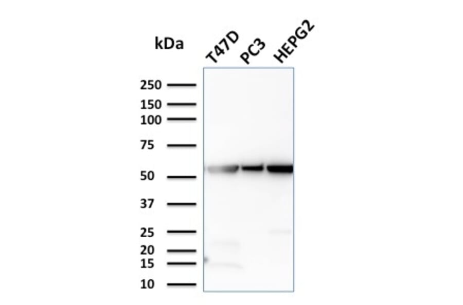 Western Blot - Anti-Glucose 6 Phosphate Isomerase Antibody [CPTC-GPI-1] (A248753) - Antibodies.com