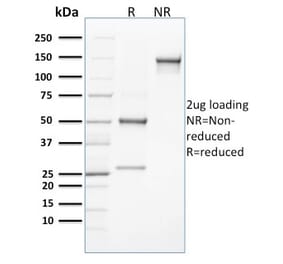SDS-PAGE - Anti-CLEC9A Antibody [8F9] (A248753) - Antibodies.com
