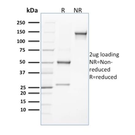 SDS-PAGE - Anti-CLEC9A Antibody [8F9] (A248753) - Antibodies.com