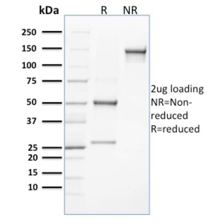 SDS-PAGE - Anti-CLEC9A Antibody [8F9] (A248753) - Antibodies.com