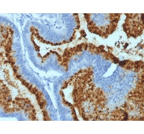 Immunohistochemistry - Anti-Blood Group Antigen B Antibody [HEB-20] (A248755) - Antibodies.com