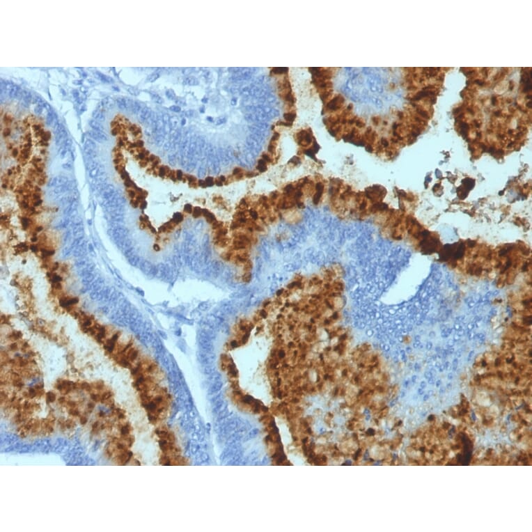 Immunohistochemistry - Anti-Blood Group Antigen B Antibody [HEB-20] (A248755) - Antibodies.com