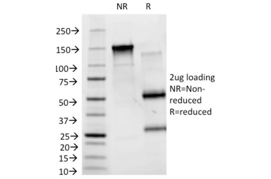 SDS-PAGE - Anti-Blood Group Antigen B Antibody [HEB-20] (A248756) - Antibodies.com