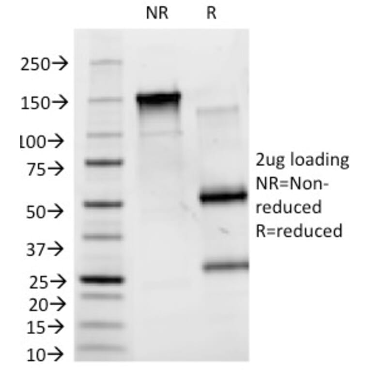 SDS-PAGE - Anti-Blood Group Antigen B Antibody [HEB-20] (A248756) - Antibodies.com