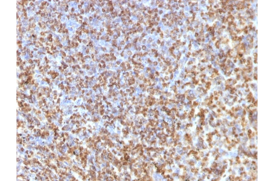 Immunohistochemistry - Anti-Galectin 13 Antibody [PP13/1161] (A248762) - Antibodies.com