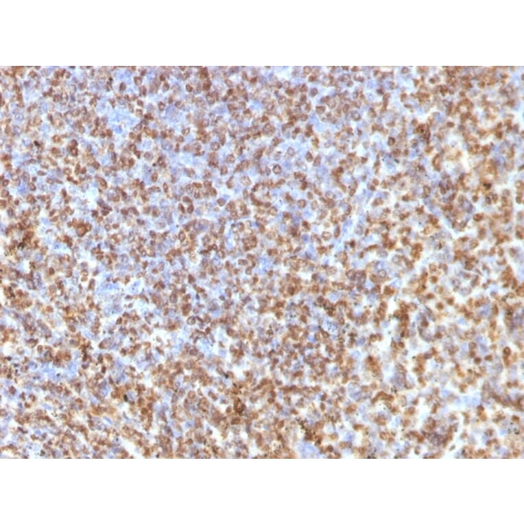 Immunohistochemistry - Anti-Galectin 13 Antibody [PP13/1161] (A248762) - Antibodies.com