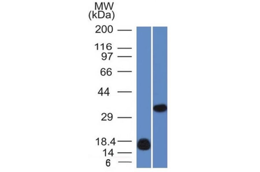 Western Blot - Anti-Galectin 13 Antibody [PP13/1161] (A248762) - Antibodies.com