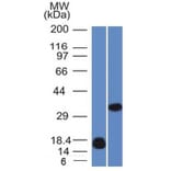 Western Blot - Anti-Galectin 13 Antibody [PP13/1161] (A248762) - Antibodies.com