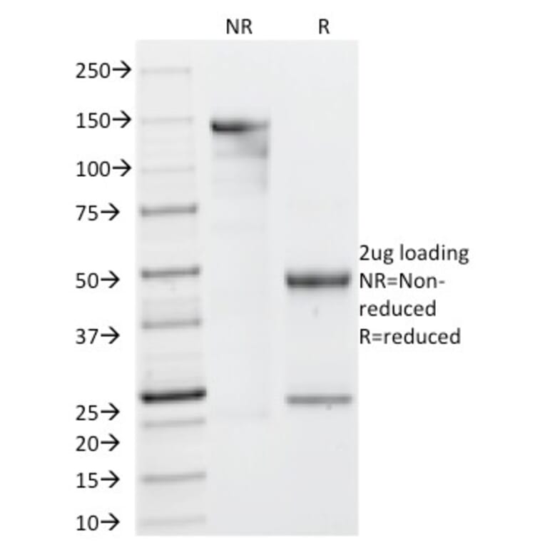 SDS-PAGE - Anti-Galectin 13 Antibody [PP13/1161] (A248762) - Antibodies.com