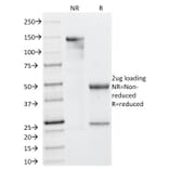 SDS-PAGE - Anti-Galectin 13 Antibody [PP13/1161] (A248762) - Antibodies.com