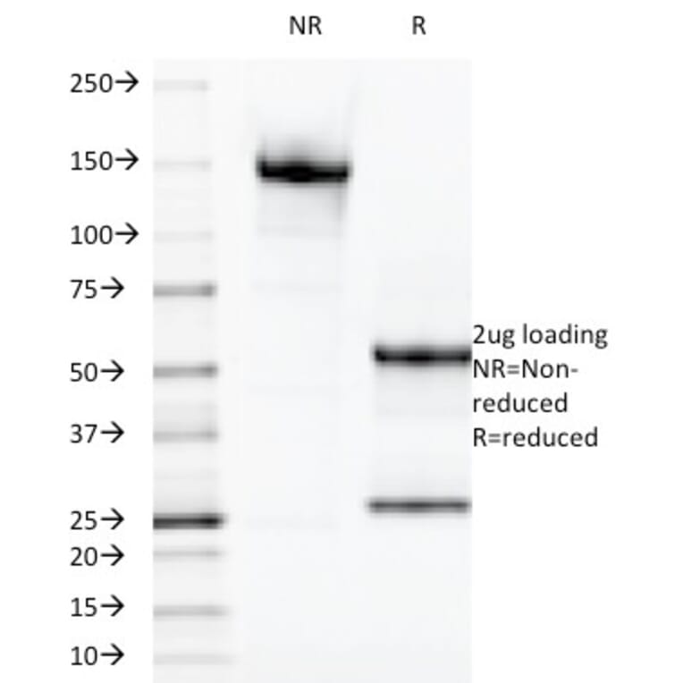 SDS-PAGE - Anti-Galectin 13 Antibody [PP13/1165] (A248765) - Antibodies.com