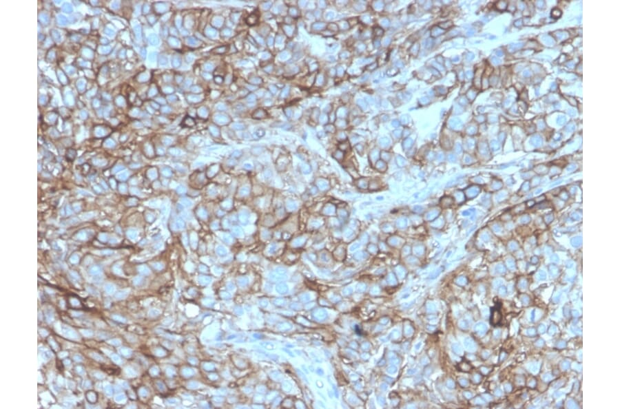 Immunohistochemistry - Anti-PD-L1 Antibody [rPDL1/4772] (A248766) - Antibodies.com