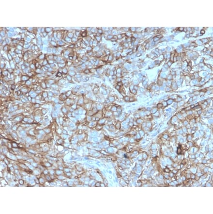 Immunohistochemistry - Anti-PD-L1 Antibody [rPDL1/4772] (A248766) - Antibodies.com