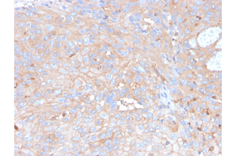 Immunohistochemistry - Anti-PD-L1 Antibody [rPDL1/4773] (A248767) - Antibodies.com