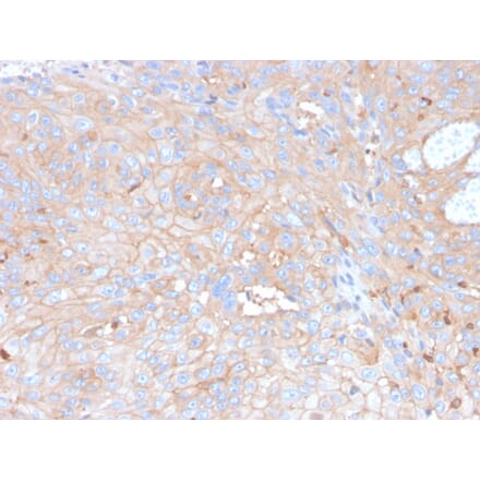 Immunohistochemistry - Anti-PD-L1 Antibody [rPDL1/4773] (A248767) - Antibodies.com