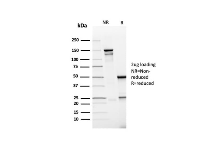 SDS-PAGE - Anti-PD-L1 Antibody [rPDL1/4773] (A248767) - Antibodies.com