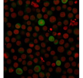 Immunofluorescence - Anti-PD-L1 Antibody [PDL1/2743] (A248770) - Antibodies.com