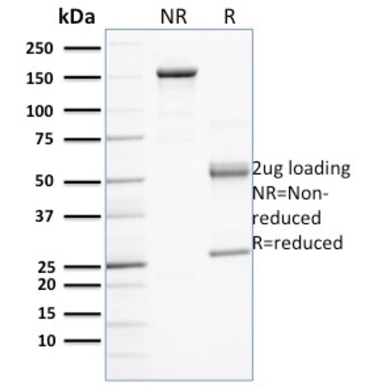 SDS-PAGE - Anti-PD-L1 Antibody [PDL1/2743] (A248770) - Antibodies.com