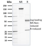 SDS-PAGE - Anti-PD-L1 Antibody [PDL1/2743] (A248770) - Antibodies.com
