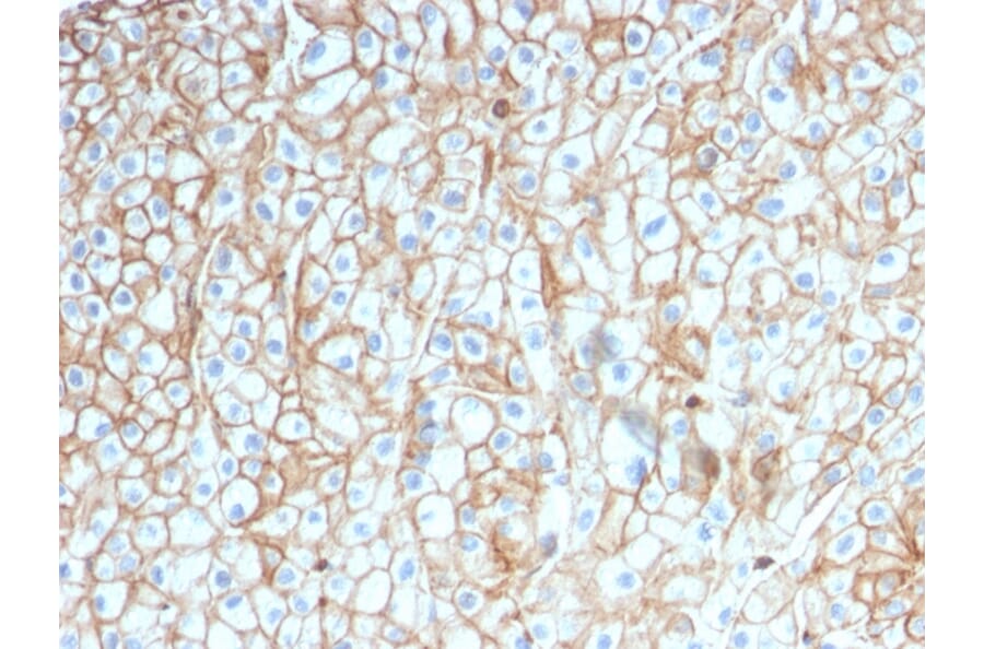 Immunohistochemistry - Anti-PD-L1 Antibody [PDL1/2746] (A248773) - Antibodies.com