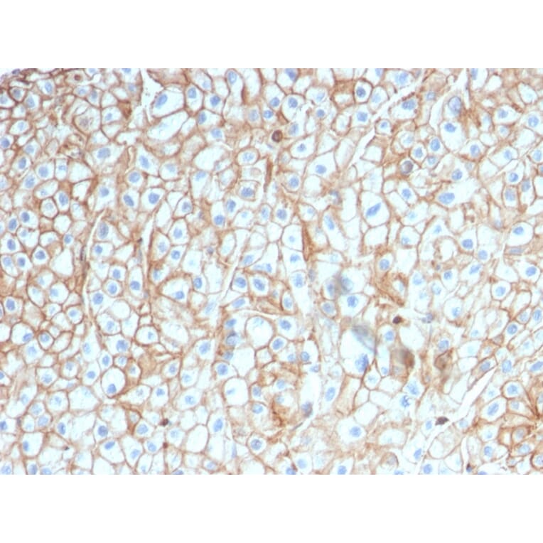 Immunohistochemistry - Anti-PD-L1 Antibody [PDL1/2746] (A248773) - Antibodies.com
