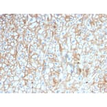 Immunohistochemistry - Anti-PD-L1 Antibody [PDL1/2746] (A248773) - Antibodies.com
