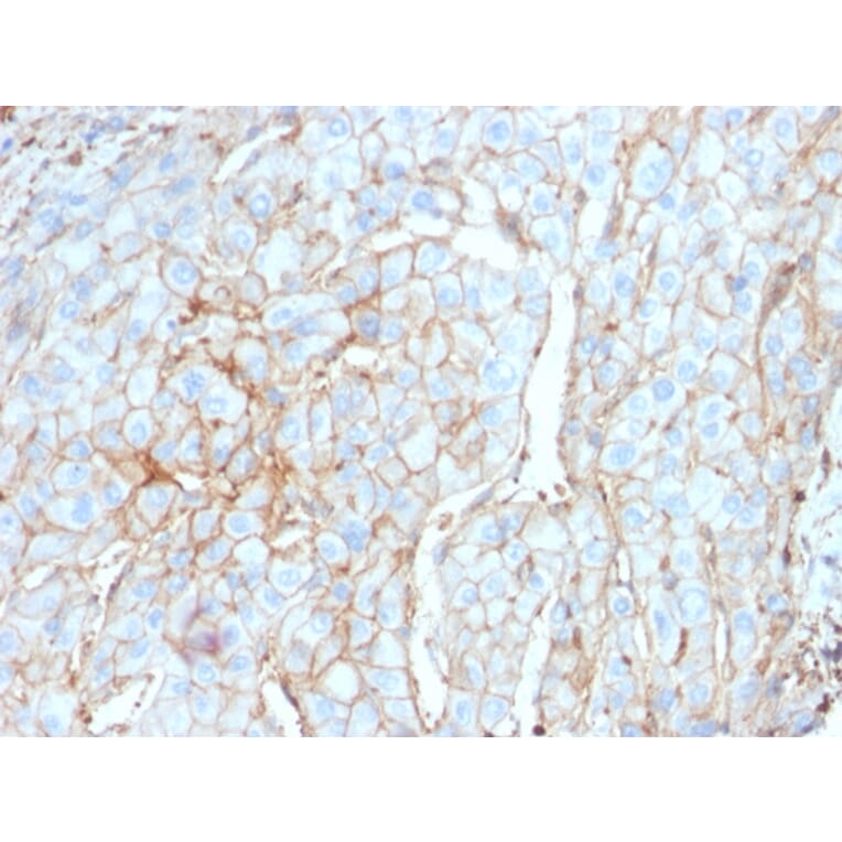 Immunohistochemistry - Anti-PD-L1 Antibody [PDL1/2746] (A248773) - Antibodies.com