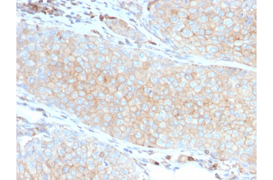 Immunohistochemistry - Anti-PD-L1 Antibody [PDL1/2746] (A248772) - Antibodies.com