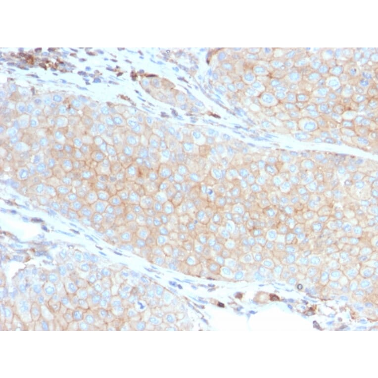 Immunohistochemistry - Anti-PD-L1 Antibody [PDL1/2746] (A248772) - Antibodies.com