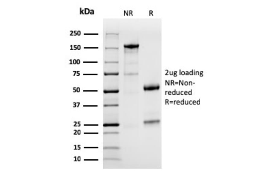SDS-PAGE - Anti-PD-L1 Antibody [PDL1/2746] (A248773) - Antibodies.com