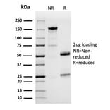SDS-PAGE - Anti-PD-L1 Antibody [PDL1/2746] (A248773) - Antibodies.com