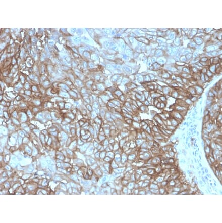 Immunohistochemistry - Anti-PD-L1 Antibody [PDL1/4280R] (A248773) - Antibodies.com