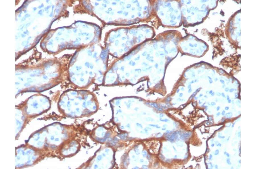Immunohistochemistry - Anti-PD-L1 Antibody [PDL1/4280R] (A248774) - Antibodies.com