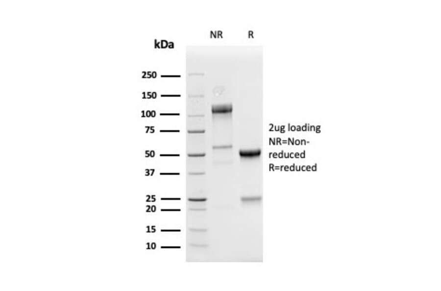 SDS-PAGE - Anti-PD-L1 Antibody [PDL1/4280R] (A248774) - Antibodies.com
