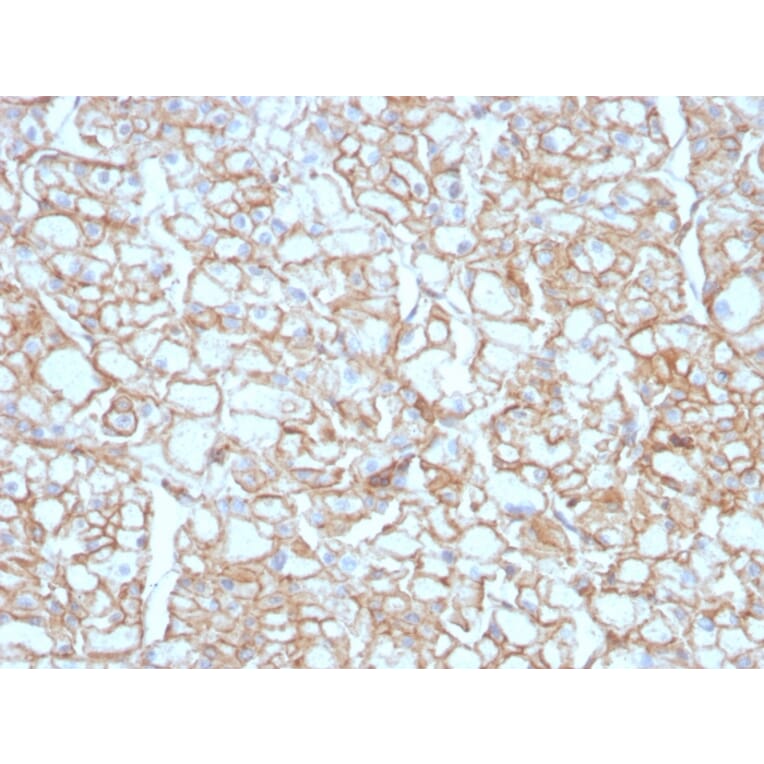 Immunohistochemistry - Anti-PD-L1 Antibody [PDL1/4451R] (A248775) - Antibodies.com