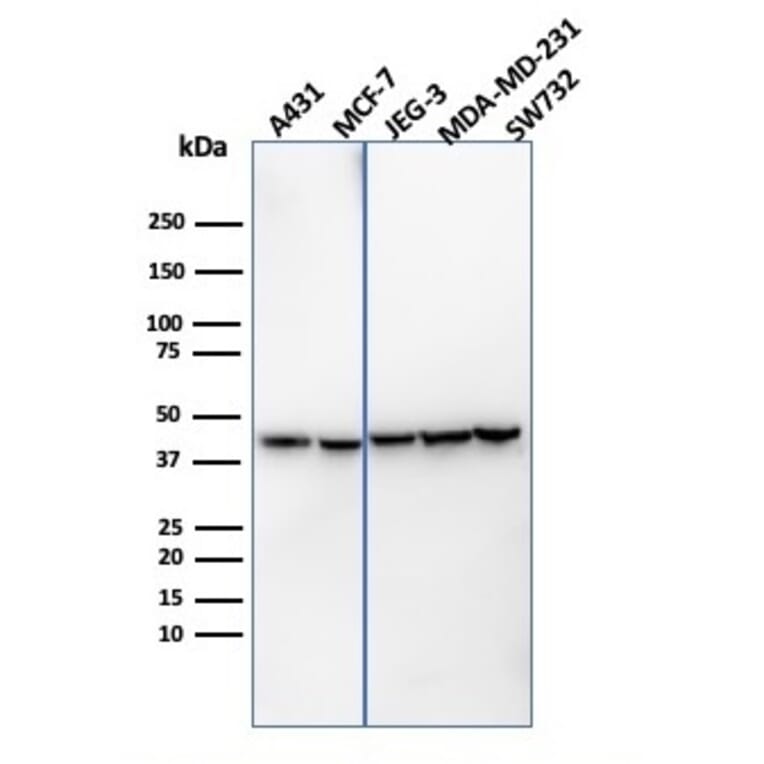 Western Blot - Anti-PD-L1 Antibody [PDL1/4451R] (A248775) - Antibodies.com