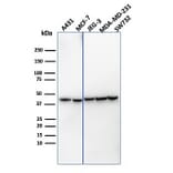 Western Blot - Anti-PD-L1 Antibody [PDL1/4451R] (A248775) - Antibodies.com