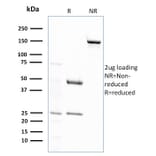 SDS-PAGE - Anti-Glutathione S Transferase Mu 2 Antibody [CPTC-GSTMu2-2] (A248778) - Antibodies.com
