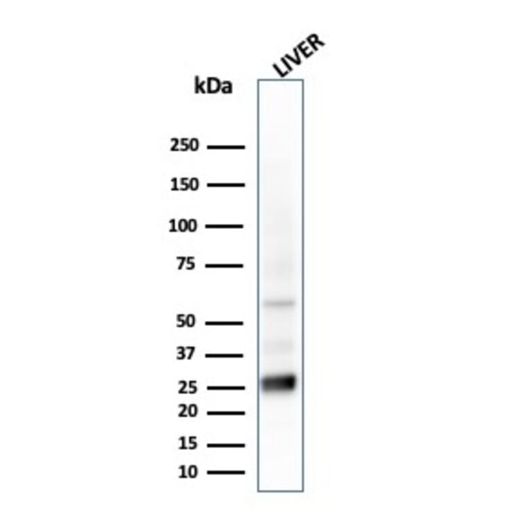 Western Blot - Anti-Glutathione S Transferase Mu 2 Antibody [CPTC-GSTMu2-2] (A248778) - Antibodies.com