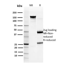 SDS-PAGE - Anti-Glutathione S Transferase Mu 3 Antibody [CPTC-GSTMu3-1] (A248779) - Antibodies.com