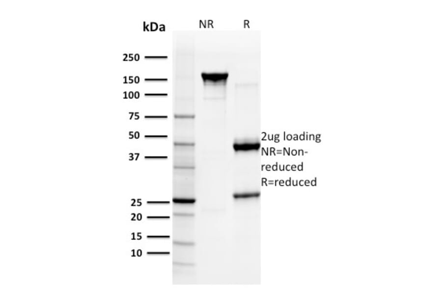 SDS-PAGE - Anti-Glutathione S Transferase Mu 3 Antibody [CPTC-GSTMu3-1] (A248779) - Antibodies.com