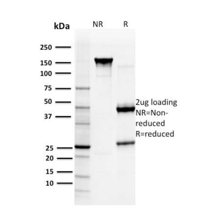 SDS-PAGE - Anti-Glutathione S Transferase Mu 3 Antibody [CPTC-GSTMu3-1] (A248779) - Antibodies.com