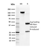SDS-PAGE - Anti-Glutathione S Transferase Mu 3 Antibody [CPTC-GSTMu3-1] (A248779) - Antibodies.com