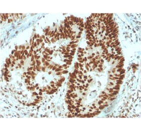Immunohistochemistry - Anti-MSH6 Antibody [MSH6/3091] (A248780) - Antibodies.com
