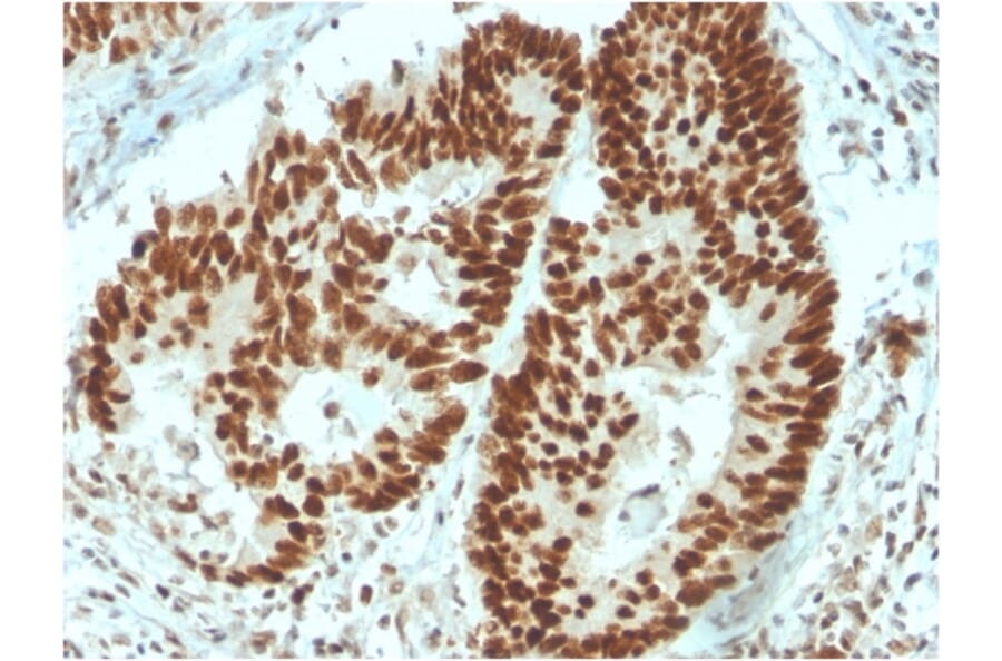Immunohistochemistry - Anti-MSH6 Antibody [MSH6/3091] (A248780) - Antibodies.com