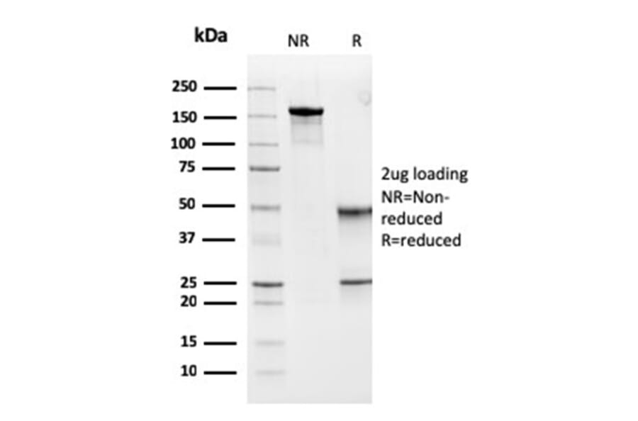 SDS-PAGE - Anti-MSH6 Antibody [MSH6/3091] (A248780) - Antibodies.com