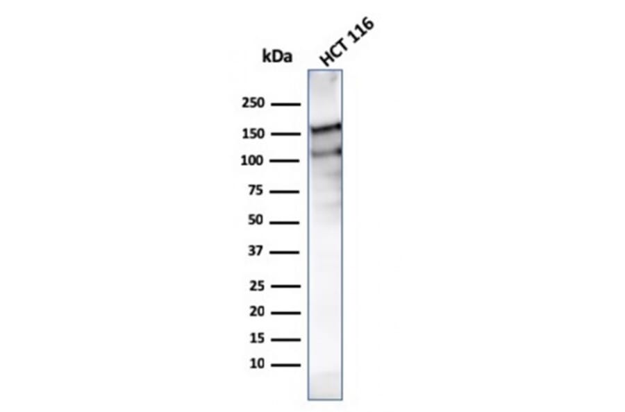 Western Blot - Anti-MSH6 Antibody [MSH6/3091] (A248780) - Antibodies.com