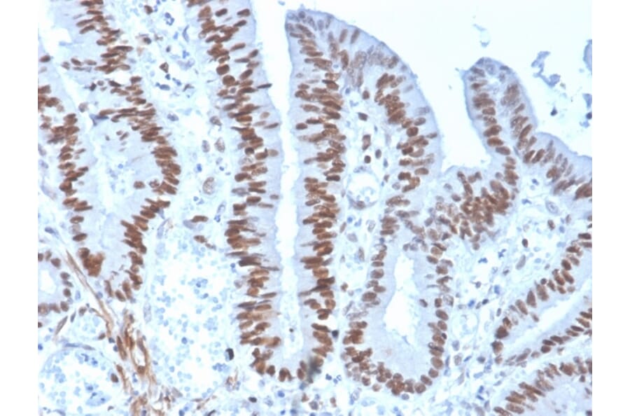 Immunohistochemistry - Anti-MSH6 Antibody [rMSH6/4743] (A248780) - Antibodies.com