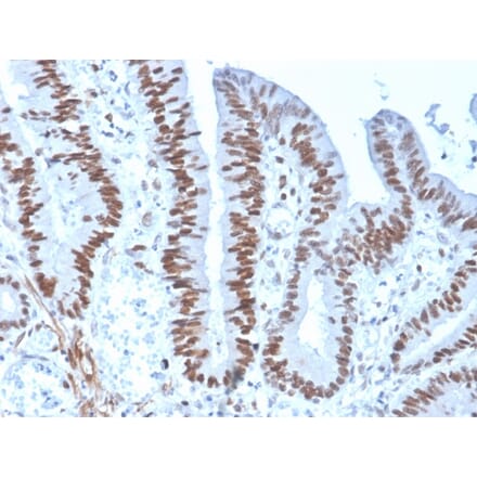 Immunohistochemistry - Anti-MSH6 Antibody [rMSH6/4743] (A248780) - Antibodies.com